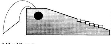 some generic structure